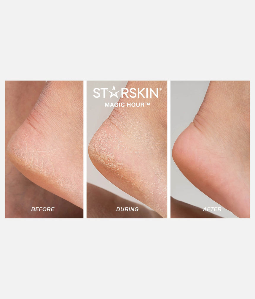 Exfoliating Foot Mask for Smooth, Soft, and Nourished Feet - MAGIC HOUR